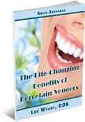 benefits of veneers