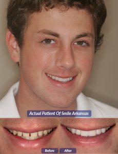 patient of smile arkansas