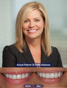 patient of smile arkansas